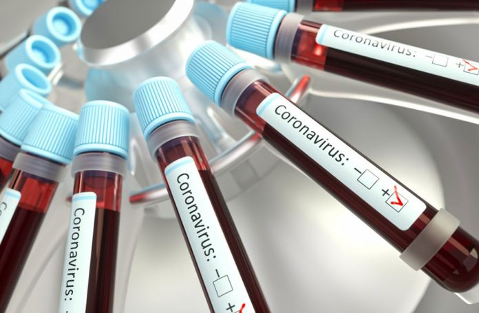 Coronavirus