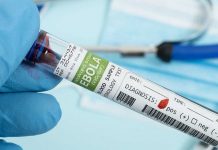 Aumentan casos de ébola en República Democrática del Congo